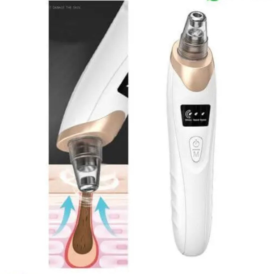 Original Multifunctional Blackheads Remover