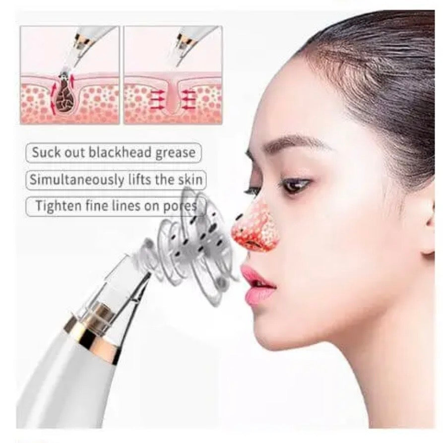 Original Multifunctional Blackheads Remover